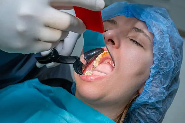 Maxillofacial surgery consultation at Gold's Dental Clinic in Kalapatti, Coimbatore