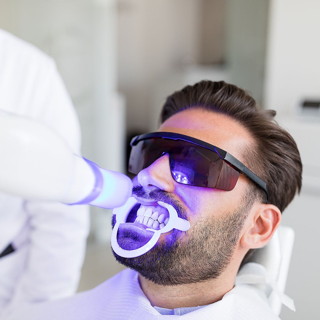 Professional teeth whitening treatment with UV light at Gold's Dental Clinic